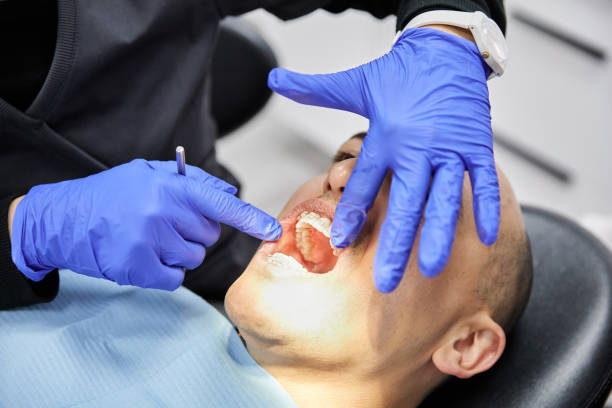 Best Emergency Treatment for Dental Infections or Abscesses in Little River, SC